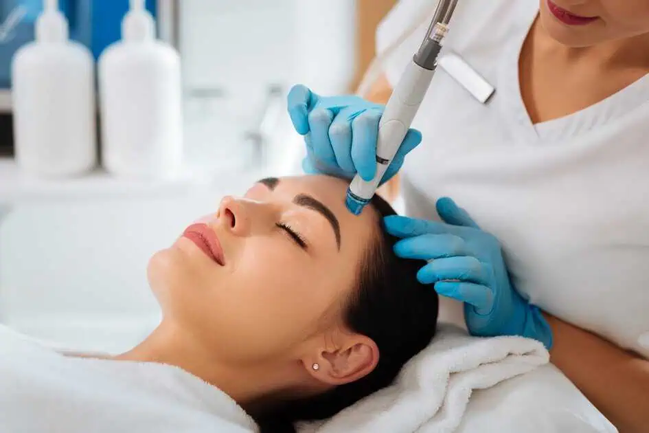 Microneedling Facial in Grove City by Astria Aesthetics