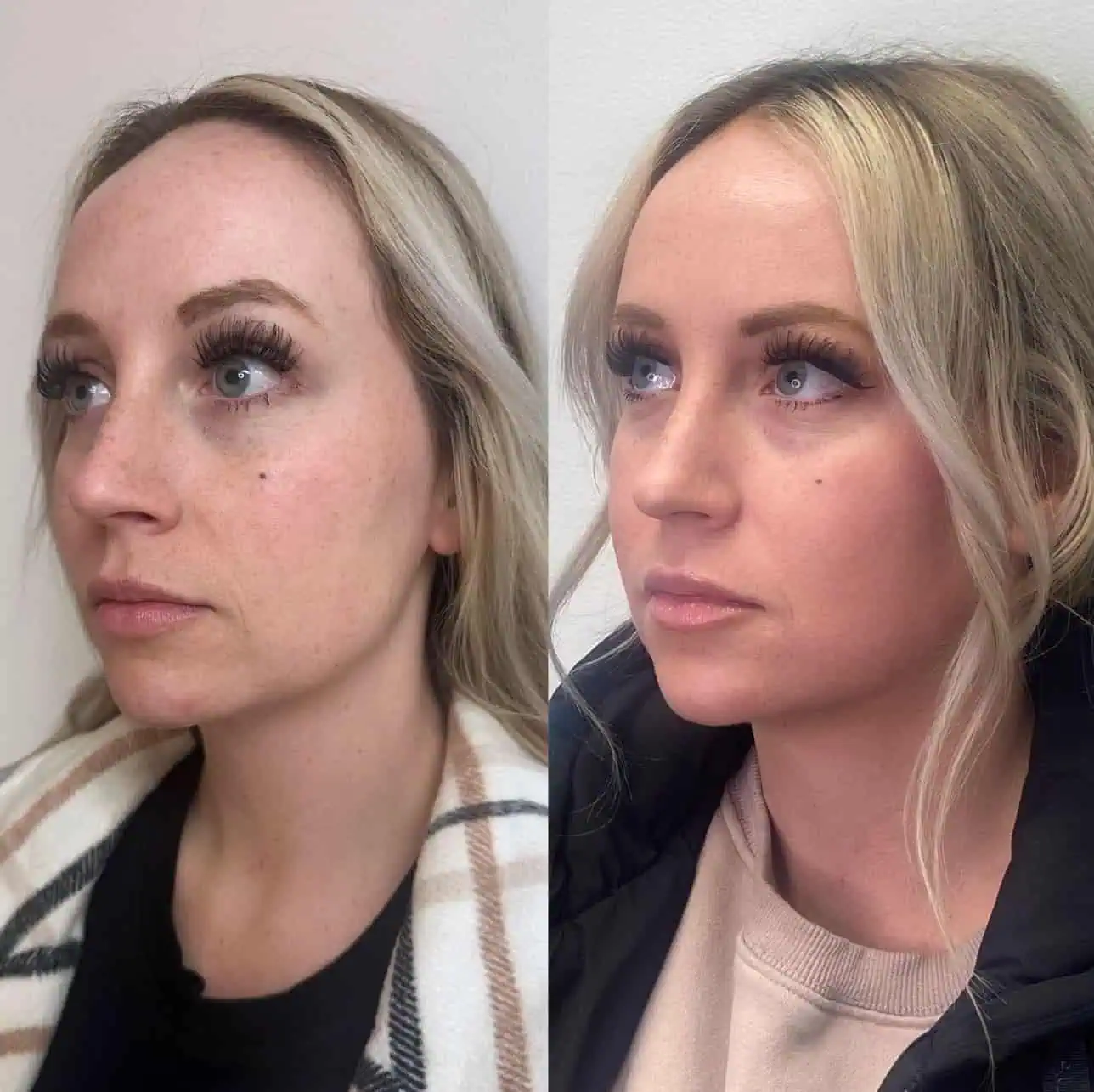 lumecca cool peel