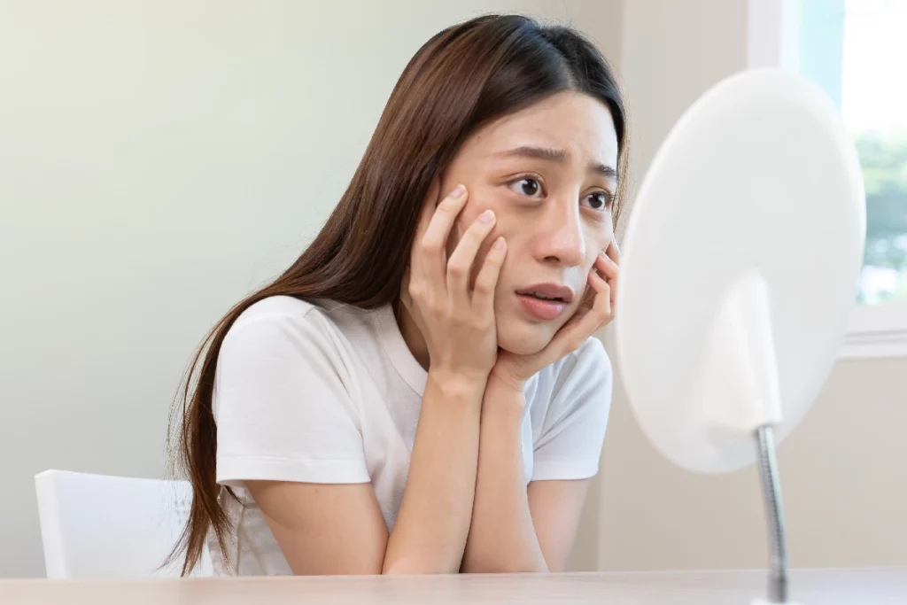 PRF under-eye treatment for improving dark circles and under-eye hollows at Astria Aesthetics.